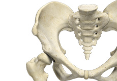 Acetabular Dysplasia