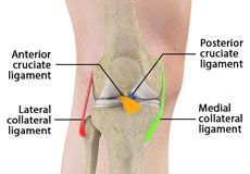 Multiligament Knee Injuries